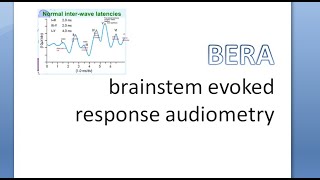 ENT ElectroCochleoGraphy and BERA Brainstem Evoked Response Audiometry [upl. by Prescott631]