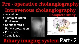 Preoperative cholangiography  Intravenous cholangiography  IVC  biliary imaging system part  2 [upl. by Evelinn]