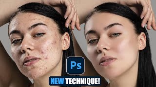 Face Retouching  Best Photoshop Tutorial  Skin Retouching smoothskin [upl. by Finkelstein]