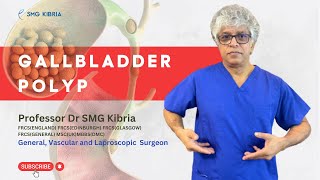 What is Gallbladder Polyp Causes Signs Symptoms and Treatment । Things You Need To Know [upl. by Lydnek]