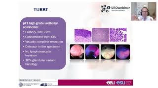 Urowebinar BCG unresponsive disease how this definition impact your treatment decision making [upl. by Ahseet]