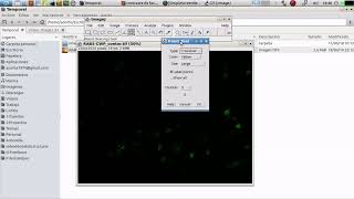 ImageJ – Conteo manual de elementos en una imagen [upl. by Carly81]