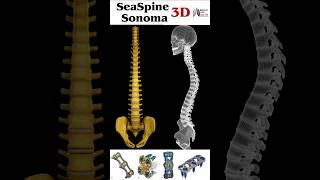 Spine Sonoma medical animation 3d short  BiologywithAliya [upl. by Nylireg]