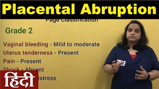 Antepartum Hemorrhage in Hindi  Placental Abruption Clinical Types Grading Signs  Nursing Lecture [upl. by Rosario]