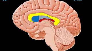 Understanding Disorders of the Corpus Callosum Animated Video by NODCC [upl. by Ydal697]