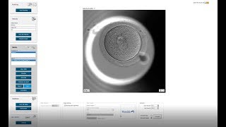 EmbryoViewer software  Create and Export videos [upl. by Assel]