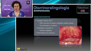 Curso CT ootorrinolaringologia  5 Estomatología [upl. by Ivette]