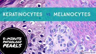 Melanocytes vs Keratinocytes Made Easy 5Minute Pathology Pearls [upl. by Ennovy]