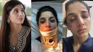 Mawara Hussain injured jafa BTS  Marwa hocane accident [upl. by Milly]