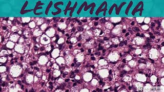 Leishmaniasis 5Minute Pathology Pearls [upl. by Ecneralc857]