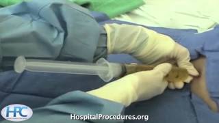 Paracentesis Procedure Video Trailer [upl. by Nasho885]