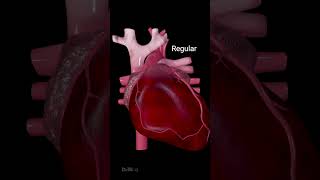 Heart Arrhythmias Different Types and Symptoms [upl. by Eberhart]