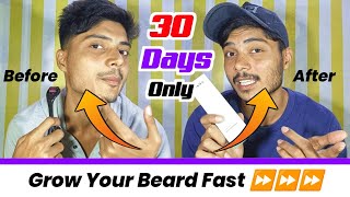 How To Use Derma Roller For Beard Growth Fast🧔⏩  Beard Growth Tips 2023  Mars Derma Roller Review [upl. by Goetz]