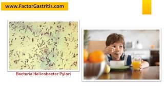 TRATAMIENTO PARA HELICOBACTER PYLORI EN NIÑOS [upl. by Odoric]