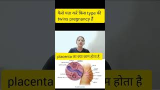 kaise pata kre kis type ki twins pregnancy hai twins pregnancy me placenta kya kaam krta hai twins [upl. by Ob]