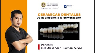 Cerámicas Dentales [upl. by Enirak]