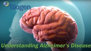 Understanding Alzheimers Disease AD [upl. by Ajoop]