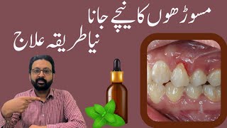 How to Use Peppermint Oil for Receding Gums Natural Gum Care Tips [upl. by Hali]