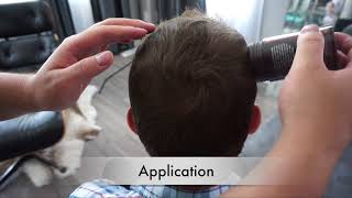 BEST HAIR LOSS TRICK 2017 [upl. by Nuhs]