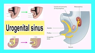 urogenital sinus [upl. by Leuamme762]