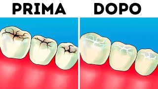 8 Passaggi Per Rendere I Denti Più Bianchi a Casa Tua [upl. by Razec]