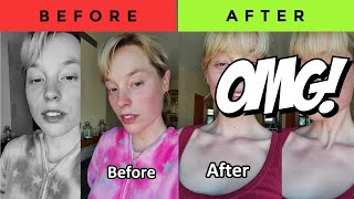 I Used JAWZRSIZE For 5 Minutes Every Day for 2 Weeks RESULTS [upl. by Nosnev]