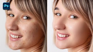 Retouch Skin in Seconds  Photoshop Tutorial  Skin Retouching [upl. by Merete120]