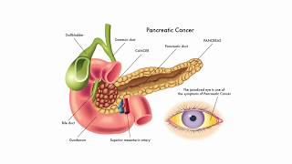 Pancreatic Diseases  English  The Gastro Specialist [upl. by Areip639]