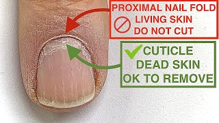 HOW to FIX CUTICLES YOUVE BEEN CUTTING THE WRONG THING 🤯🥵 [upl. by Barth334]