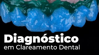 Como fazer o diagnóstico correto para Clareamento Dental em 2024 Adeus sensibilidade [upl. by Nilesoy]