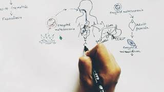 Fasciola Hepatica lifecycle  Hindi   Liver Fluke  Lifecycle [upl. by Elazaro]