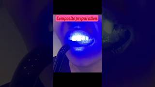 composite preparation dentist drshakeelsa composite preparation foryou shorts [upl. by Panthia]