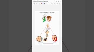 CONGENITAL RUBELLA SYNDROME [upl. by Ferdinand971]