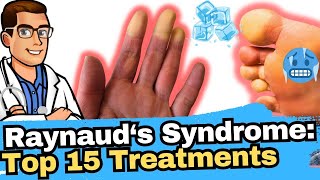 Raynauds Syndrome vs Phenomenon vs Disease Why Are My Toes Cold [upl. by Sauncho]