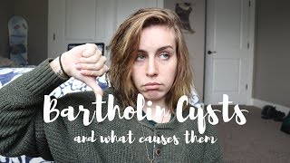 BARTHOLIN CYSTS What are they and what causes them [upl. by Northrop]