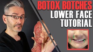 ADVANCED BOTOX ANATOMY How to avoid nasty lowerface side effects Aesthetics Mastery Show [upl. by Retla]