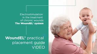 WoundEL Electrostimulation therapy [upl. by Riabuz]