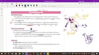 Pediatrics cardiology  tricuspid atresia amp ebstein anomaly amp truncus arteriosus [upl. by Clari]