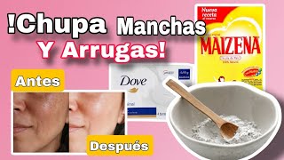 ✅️ Como eliminar MANCHAS en la cara por el sol CON ESTA MASCARILLA CASERA [upl. by Yffat394]