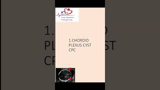 Choroid plexus cyst  Antenatal scan  Downs syndrome choroidplexuscyst [upl. by Ikcir]