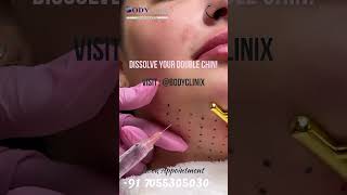 Say Goodbye to Double Chin  Effective Treatment at BodyClinix [upl. by Eeliab]