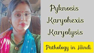 pyknosis  karyohexis  karyolysis in hindi [upl. by Pennebaker]