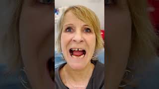 DENTAL IMPLANTS IN TURKEY  🦷 Nadias testimony 3 implants  bone graft  24 crowns  BODYEXPERT [upl. by Kcirdneked803]