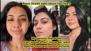 Reem Shaikh reveals how she got Scars Talks about her parents fear going against them to post Pics [upl. by Randall]