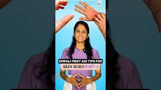 Diwali First Aid Tips For Skin Burn  Must Watch [upl. by Rez]