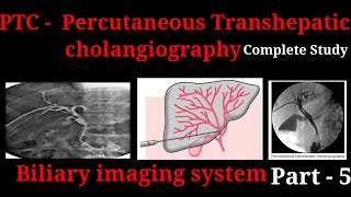 Percutaneous Transhepatic Cholangiography  PTC  Procedure  Biliary imaging system part  5 [upl. by Lada115]