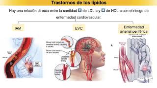 Tratamiento de dislipidemias [upl. by Lucio]