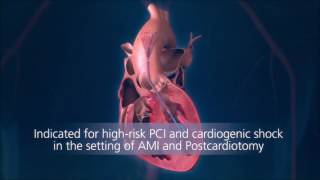 Impella® Heart Pump Animation For Physicians [upl. by Marden]