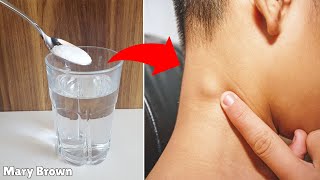 Home Remedies for Swollen Lymph Nodes [upl. by Gosney]