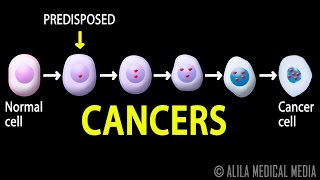 Cancer How Cancer Starts How Cancer Spreads Where and Why Animation [upl. by Viveca973]